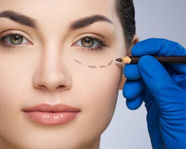 How To Reduce Under Eye Bags