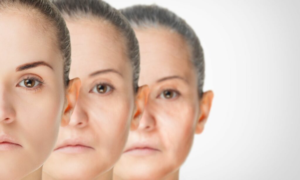 Aging - why women get wrinkles