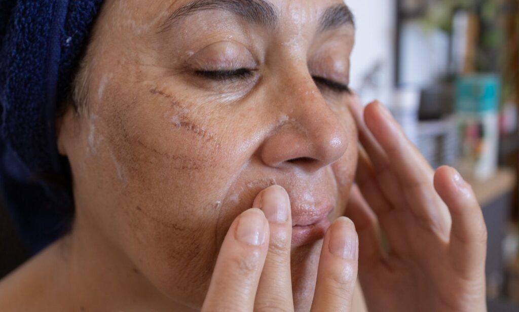 Is a TCA Peel Safe for Mature Skin? 
