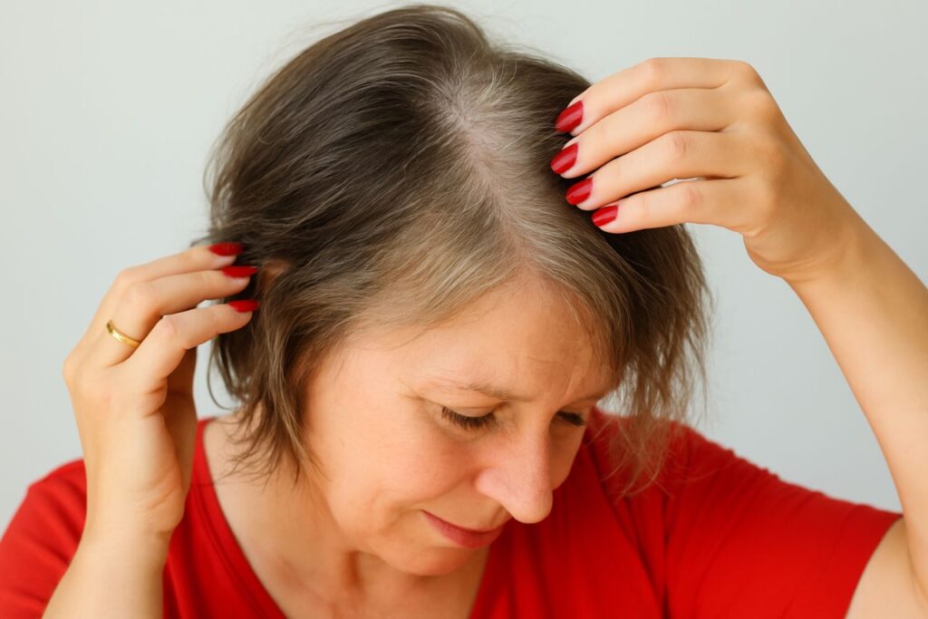 Underlying Health Conditions You Shouldn’t Ignore for hair thinning
