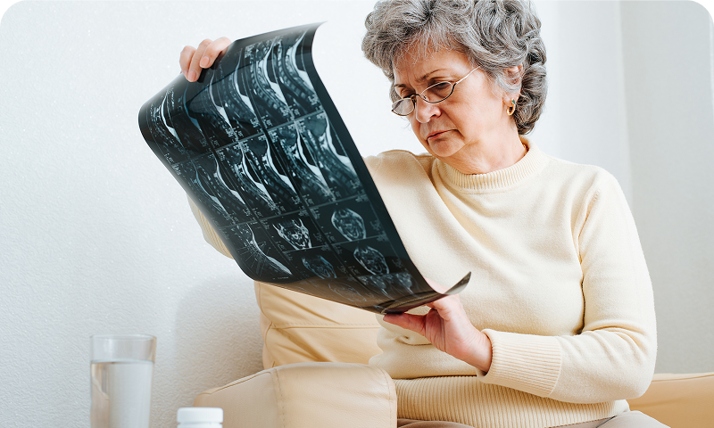 Risk Factors for Osteoporosis